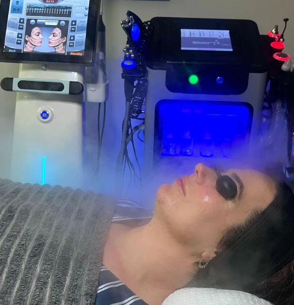 Hydrafacial, deep facial cleansing in amsterdam